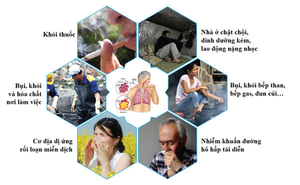 mot so tac nhan gay viem phoi